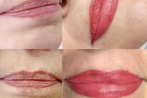 Заживление перманентного макияжа губ