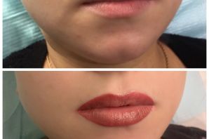 Увеличение губ перманентным макияжем