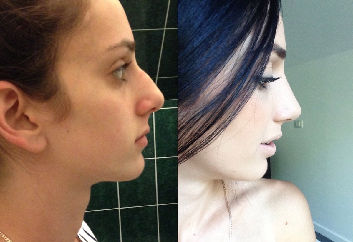 Прически для большого носа