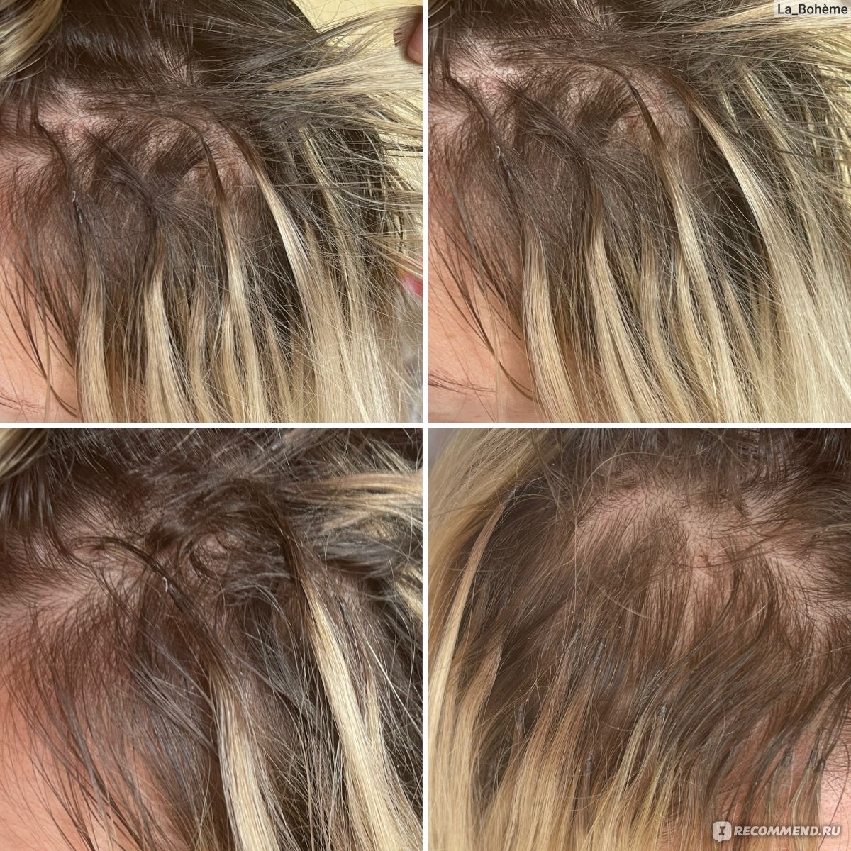 Последствия наращивания волос