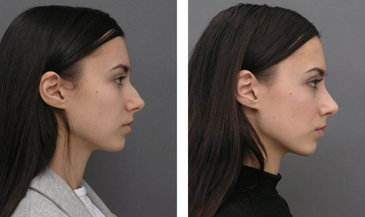 Сара Джессика Паркер улыбка