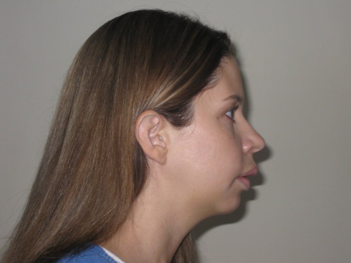 Нос с маленькой горбинкой