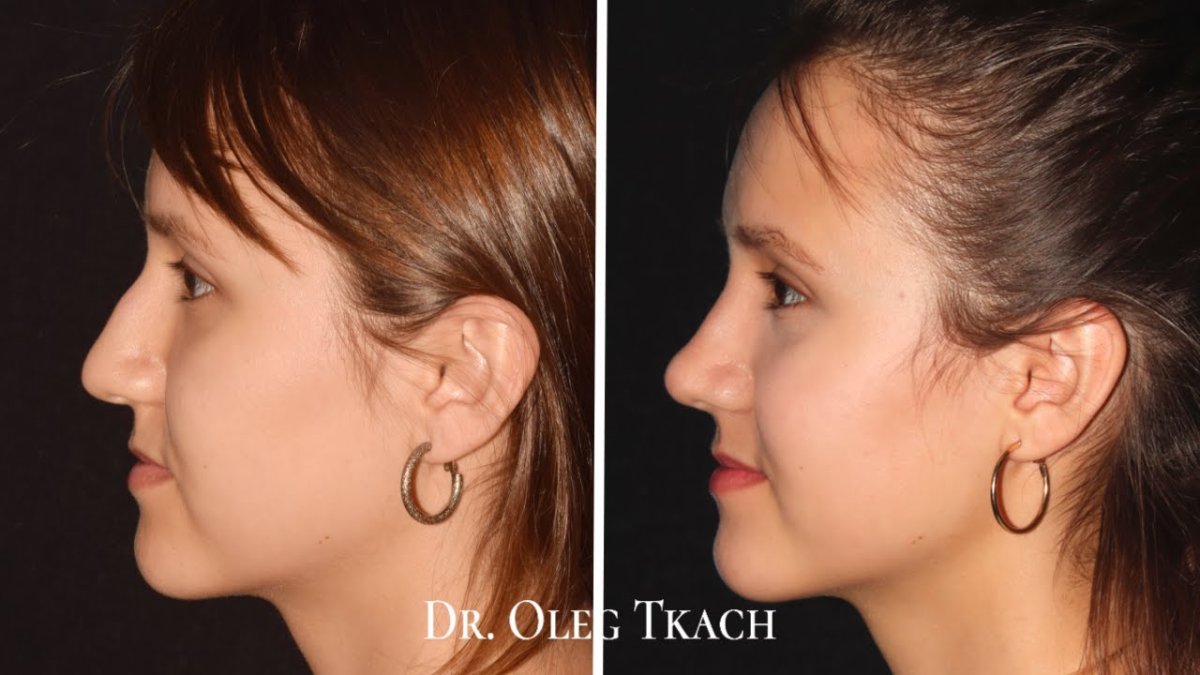 Длинный нос с горбинкой