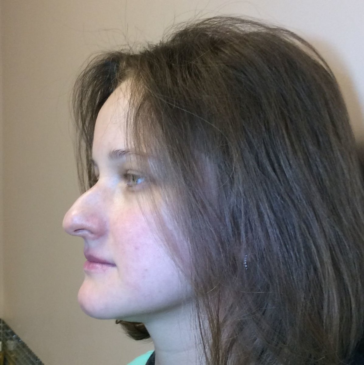 Нос с горбинкой у девушки