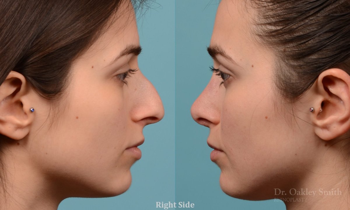 Стрижки для длинного носа женские